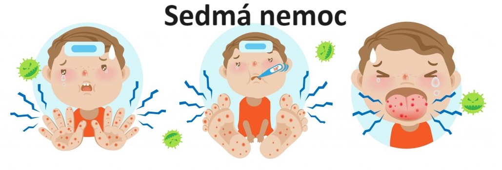 Upozornění pro rodiče
